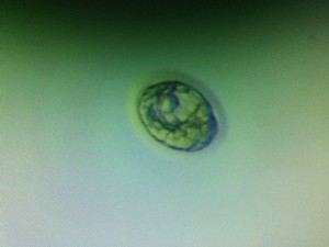 Vår blastocyst <3